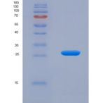 小鼠类粘蛋白2(ORM2)重组蛋白