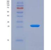小鼠类粘蛋白2(ORM2)重组蛋白