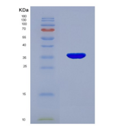人E1A结合蛋白P300(EP300)重组蛋白