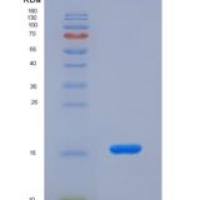 小鼠激素敏感性脂肪酶(LIPE)重组蛋白