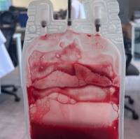 人白细胞采集（Leukopak）