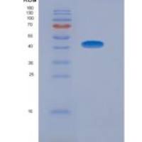 人脂联素受体1(ADIPOR1)重组蛋白