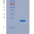 人载脂蛋白D(APOD)重组蛋白