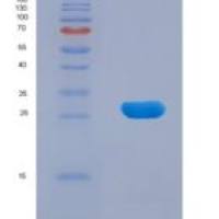 人硒结合蛋白1(SELENBP1)重组蛋白