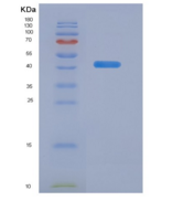 人嗜酸粒细胞趋化因子(ECF)重组蛋白