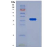 大鼠斯钙素2(STC2)重组蛋白