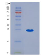 大鼠脂质运载蛋白2(NGAL)重组蛋白
