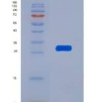 人Cholinergic Receptor, Nicotinic, Alpha 1 (CHRNa1)重组蛋白