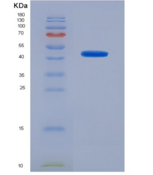 人血红蛋白β(HBb)重组蛋白