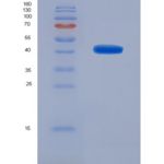 人心肌肌球蛋白结合蛋白C(MYBPC3)重组蛋白