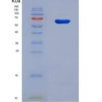 人电子传递黄素蛋白脱氢酶(ETFDH)重组蛋白