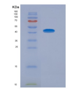 人脂联素受体1(ADIPOR1)重组蛋白