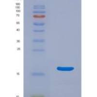 人泛素A52残留核糖体蛋白融合产物1(UBA52)重组蛋白