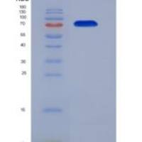 人75kDa热休克蛋白(HSP75)重组蛋白