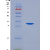 人胰岛素受体(INSR)重组蛋白