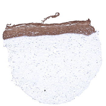 Cytokeratin 6 antibody 抗体，orb2