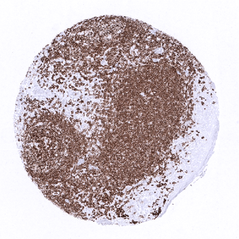 CD20 antibody 抗体，orb2276515，Bi