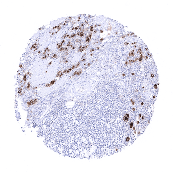 Mesothelin antibody 抗体，orb2276