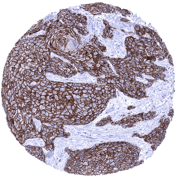Desmoglein 3 antibody 抗体，orb22