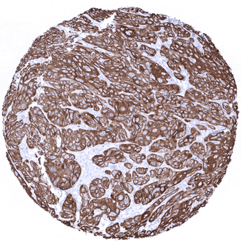 Cytokeratin 6 antibody 抗体，orb2