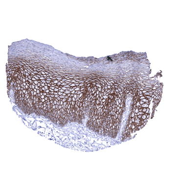 Desmoglein 3 antibody 抗体，orb22