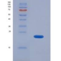 小鼠α1-微球蛋白(a1M)重组蛋白
