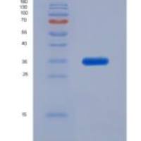 大鼠白介素4(IL4)重组蛋白