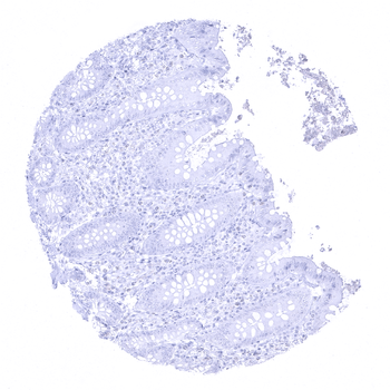 PSAP antibody 抗体，orb2276503，Bi