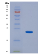 小鼠α1-微球蛋白(a1M)重组蛋白