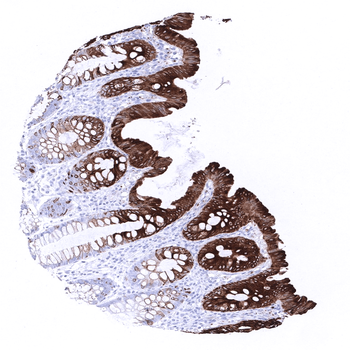 Cytokeratin 20 antibody 抗体，orb