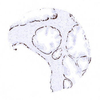 Cytokeratin 14 antibody 抗体，orb