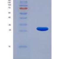 大鼠多巴胺受体D2(DRD2)重组蛋白