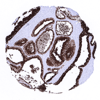 PSAP antibody 抗体，orb2276502，Bi