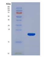 大鼠表皮生长因子受体(EGFR)重组蛋白