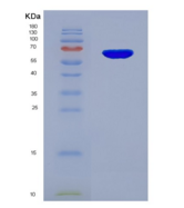 人穿孔素1(PRF1)重组蛋白