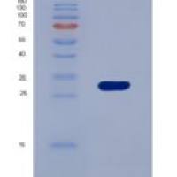 大鼠组织蛋白酶S(CTSS)重组蛋白