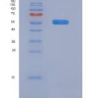 小鼠转化受体电位阳离子通道亚家族M成员4(TRPM4)重组蛋白