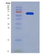 人异亮氨酰tRNA合成酶(IARS)重组蛋白