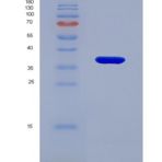 人类固醇5α还原酶2(SRD5a2)重组蛋白