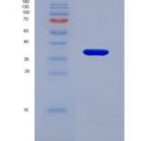 人类固醇5α还原酶2(SRD5a2)重组蛋白