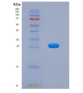 小鼠成纤维细胞激活蛋白α(FAPa)重组蛋白