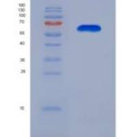 人囊性纤维化跨膜传导调节因子(CFTR)重组蛋白