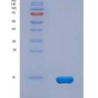 人受体相互作用丝氨酸苏氨酸激酶2(RIPK2)重组蛋白
