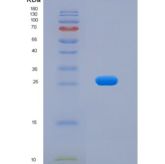 小鼠成纤维细胞激活蛋白α(FAPa)重组蛋白