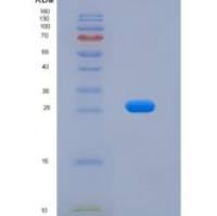 小鼠成纤维细胞激活蛋白α(FAPa)重组蛋白