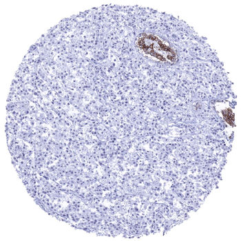 E-Cadherin Antibody 抗体，orb2276