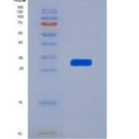 小鼠蛋白二硫化物异构酶A3(ERp57)重组蛋白