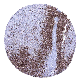 CD22 antibody 抗体，orb2276511，Bi