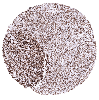 MSH2 antibody 抗体，orb2276467，Bi