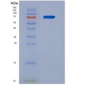 人Mdm2 p53结合蛋白同源物(MDM2)重组蛋白